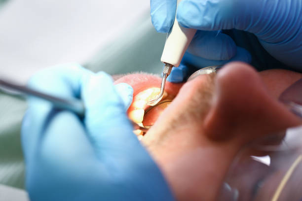 Best Emergency Treatment for Jaw Pain or Injury in Fulton, TX