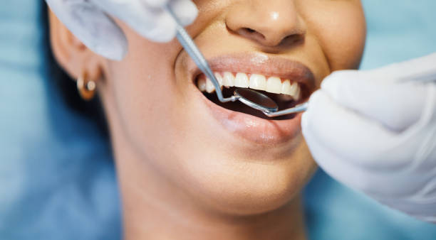 Best Emergency Root Canal Therapy in Fulton, TX