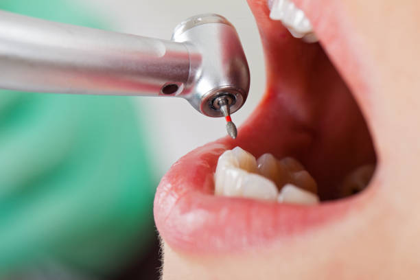 Best Emergency Pediatric Dental Care in Fulton, TX